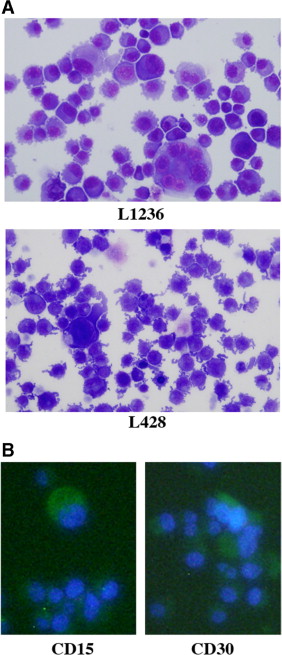 Tumorigenic Potential of Mononucleated Small Cells of Hodgkin Lymphoma Cell Lines - ScienceDirect