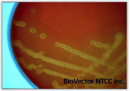 2b. Clostridium novyi Review (part 2) | HIPRA