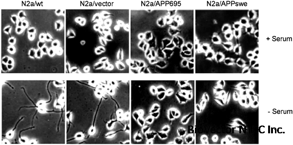 Effect of amyloid peptides on serum withdrawal-induced cell differentiation  and cell viability | Cell Research